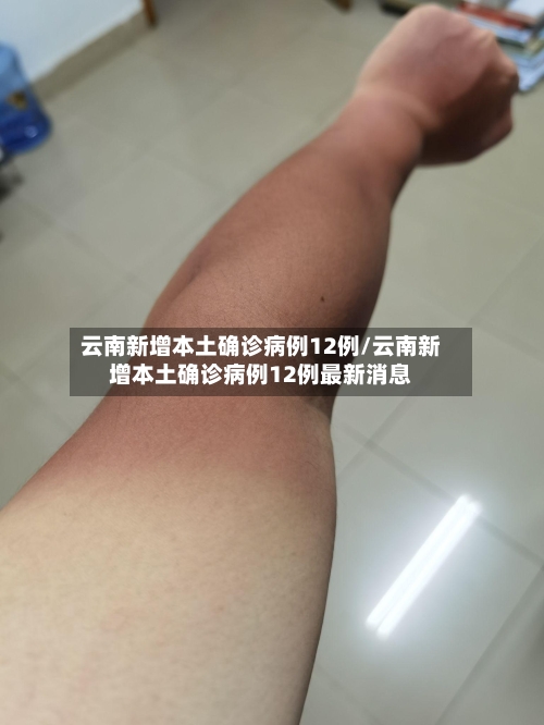 云南新增本土确诊病例12例/云南新增本土确诊病例12例最新消息-第2张图片