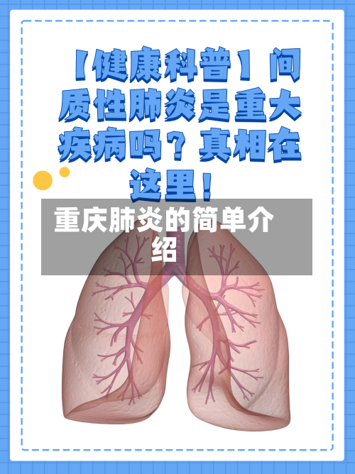 重庆肺炎的简单介绍-第2张图片